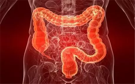 肠道息肉的危害-正解网